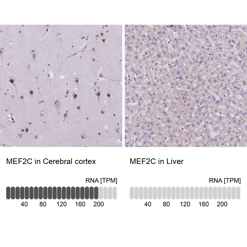 Anti-MEF2C Antibody