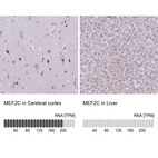 Anti-MEF2C Antibody