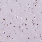 Immunohistochemical staining of human cerebral cortex shows strong nuclear positivity in neurons.