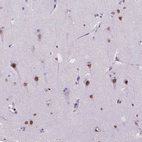 Anti-MEF2C Antibody