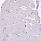 Immunohistochemical staining of human skeletal muscle shows moderate nuclear positivity in myocytes.