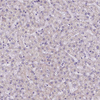 Immunohistochemical staining of human liver shows no positivity in hepatocytes as expected.