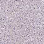 Immunohistochemical staining of human liver shows no positivity in hepatocytes as expected.