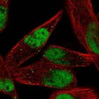 Immunofluorescent staining of human cell line RH-30 shows localization to nucleoplasm & vesicles.