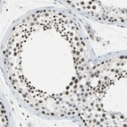 Immunohistochemical staining of human testis shows moderate nuclear positivity in cells in seminiferous ducts.