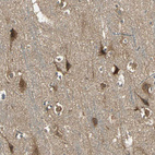 Immunohistochemical staining of human Cerebral cortex shows strong nuclear and cytoplasmic positivity in neuronal and glial cells.