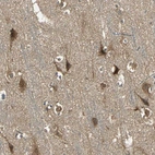 Immunohistochemical staining of human Cerebral cortex shows strong nuclear and cytoplasmic positivity in neuronal and glial cells.