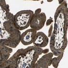 Immunohistochemical staining of human Placenta shows strong nuclear and cytoplasmic positivity in trophoblastic cells.
