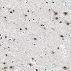 Anti-MTA1 Antibody