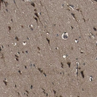 Immunohistochemical staining of human cerebral cortex shows moderate cytoplasmic positivity in neurons.