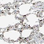 Anti-ZNF608 Antibody