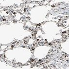 Immunohistochemical staining of human lung shows strong cytoplasmic positivity in pneumocytes.