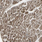 Immunohistochemical staining of human heart muscle shows strong granular cytoplasmic positivity in carrdiomyocytes.