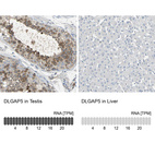 Anti-DLGAP5 Antibody