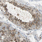 Anti-DLGAP5 Antibody