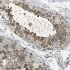 Immunohistochemical staining of human testis shows moderate cytoplasmic positivity in cells in seminiferous ducts.