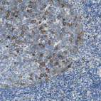 Anti-DLGAP5 Antibody