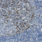 Immunohistochemical staining of human tonsil shows moderate cytoplasmic positivity in germinal center cells.