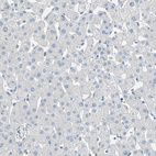 Immunohistochemical staining of human liver shows no positivity in hepatocytes as expected.