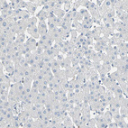 Anti-DLGAP5 Antibody