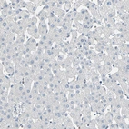 Immunohistochemical staining of human liver shows no positivity in hepatocytes as expected.