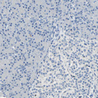 Anti-DLGAP5 Antibody