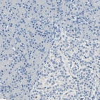 Immunohistochemical staining of human pancreas shows no positivity in exocrine or endocrine glandular cells as expected.