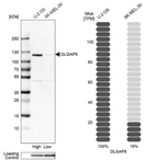 Western blot analysis in human cell lines U2OS and SK-MEL-30 using Anti-DLGAP5 antibody. Corresponding DLGAP5 RNA-seq data are presented for the same cell lines. Loading control: Anti-PPIB.