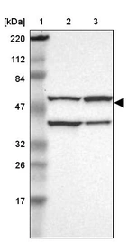 Lane 1: Marker [kDa] 220, 112, 84, 47, 32, 26, 17_br/_Lane 2: Human cell line RT-4_br/_Lane 3: Human cell line U-251MG sp