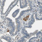 Anti-PROC Antibody