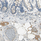 Immunohistochemical staining of human small intestine shows moderate positivity in plasma in blood vessels.