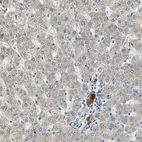 Immunohistochemical staining of human liver shows weak cytoplasmic positivity in hepatocytes and strong positivity in plasma.