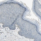 Immunohistochemical staining of human skin shows no positivity in squamous epithelial cells as expected.