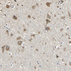 Anti-ACSL4 Antibody