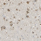 Anti-ACSL4 Antibody