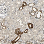 Immunohistochemical staining of human kidney shows strong cytoplasmic positivity in subset of cells in tubules.