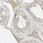 Immunohistochemical staining of human testis shows moderate cytoplasmic positivity in Leydig cells.