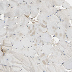 Anti-ACSL4 Antibody