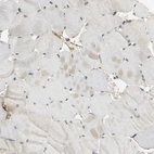 Immunohistochemical staining of human skeletal muscle shows very weak cytoplasmic positivity in myocytes.