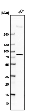 Western blot analysis in human cell line HEL.