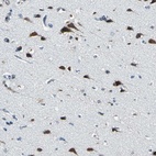 Anti-ZNF415 Antibody