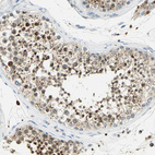 Anti-ARSA Antibody