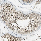 Immunohistochemical staining of human testis shows strong granular cytoplasmic positivity in cells in seminiferous ducts.