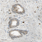 Anti-ARSA Antibody