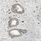 Immunohistochemical staining of human prostate shows strong granular cytoplasmic positivity in glandular cells.