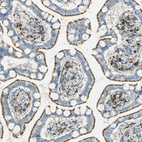 Anti-ARSA Antibody