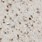 Anti-ARSA Antibody