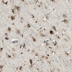 Immunohistochemical staining of human cerebral cortex shows moderate granular cytoplasmic positivity in neurons.