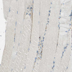 Immunohistochemical staining of human skeletal muscle shows weak positivity in myocytes as expected.