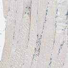 Immunohistochemical staining of human skeletal muscle shows weak positivity in myocytes as expected.